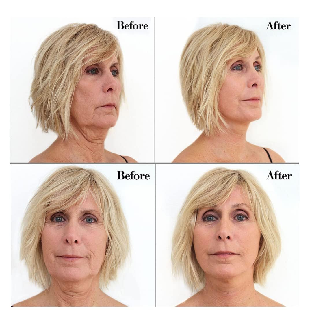 Bring It Up Instant Neck Lift Tape 30 Day Supply, Transparent Neck Lifting Anti Wrinkle Stickers - Tones Sagging Necklines Instantly - Made in USA