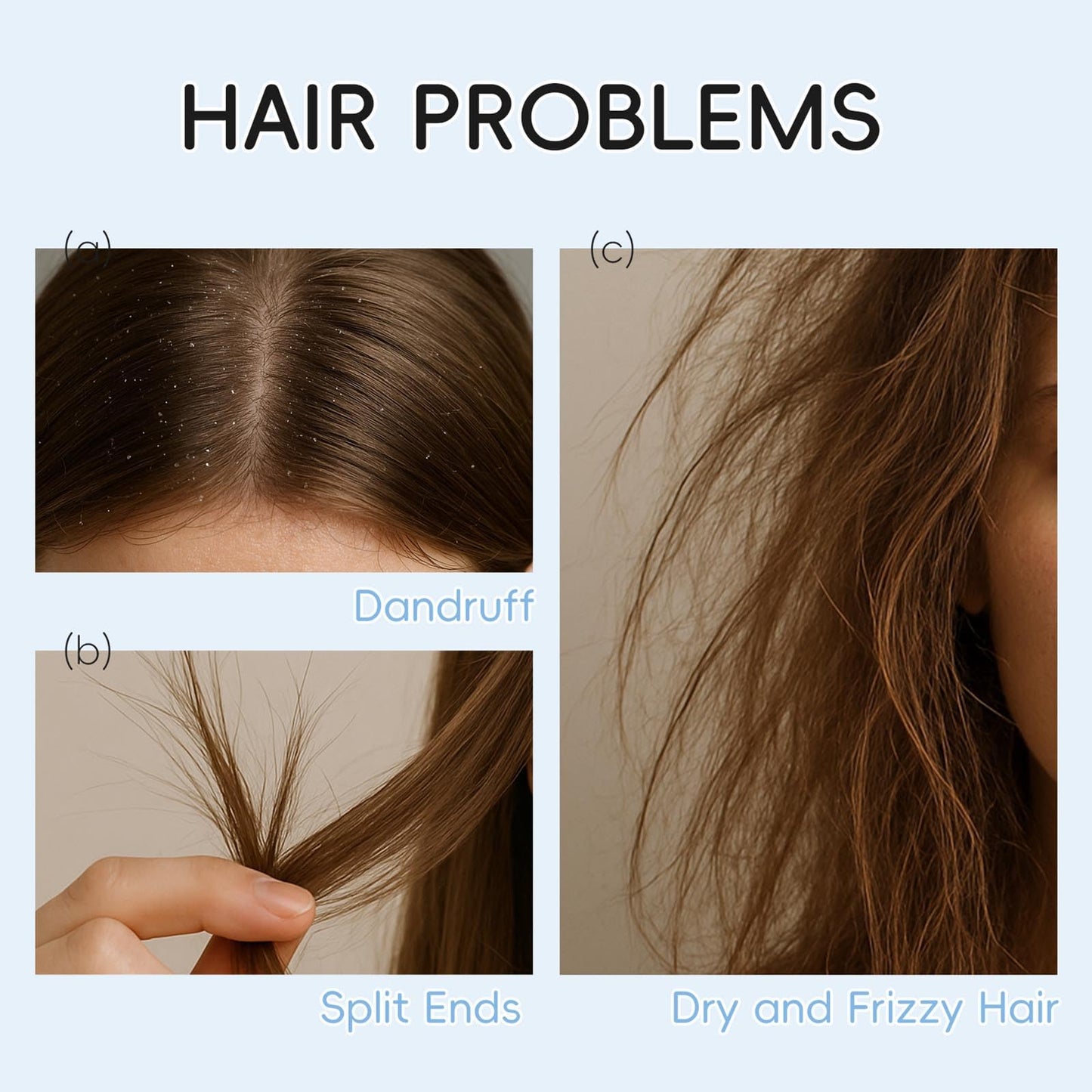 Nourishing Milk Shampoo Conditioner Set, Cleans, Removes Dandruff, Thickening, Plumps and Softens, Everyday Nourishing Formulas, for Dry, Itchy Scalp