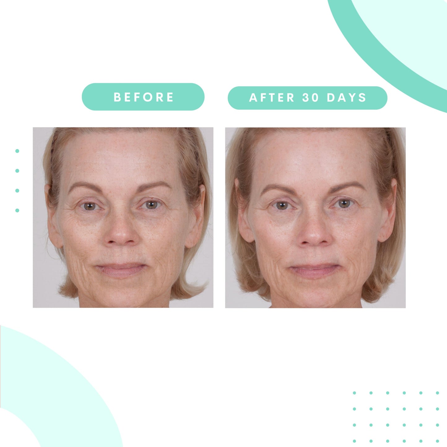 Serious Skincare Glycolic Gommage Extreme Renewal Facial Mask for Radiant Skin - Glycolic Acid - Micro Exfoliation Facial Treatment Mask - Decongest