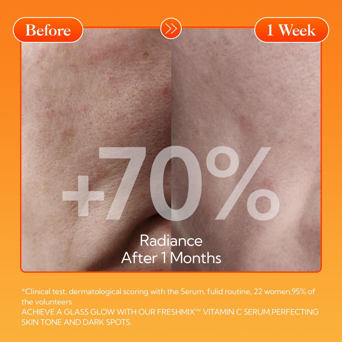 LANBENA Revolutionary Vitamin C Serum for Face, Illuminating Fcae Serum With Niacinamide, Brightening Anti-Aging Essence for Sensitive Skin