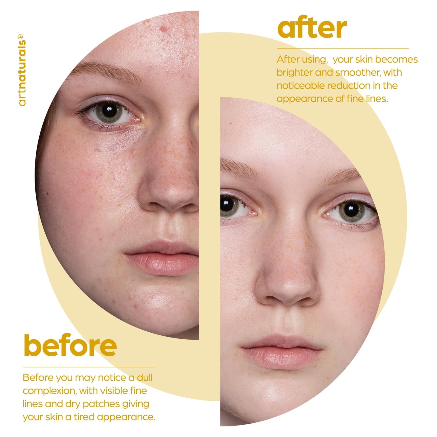 artnaturals Lactic Acid plus AHA Face Serum for Brightening Boost with Renewing Formula - Scars, Acne, Wrinkles - Exfoliates and Moisturizes the Skin