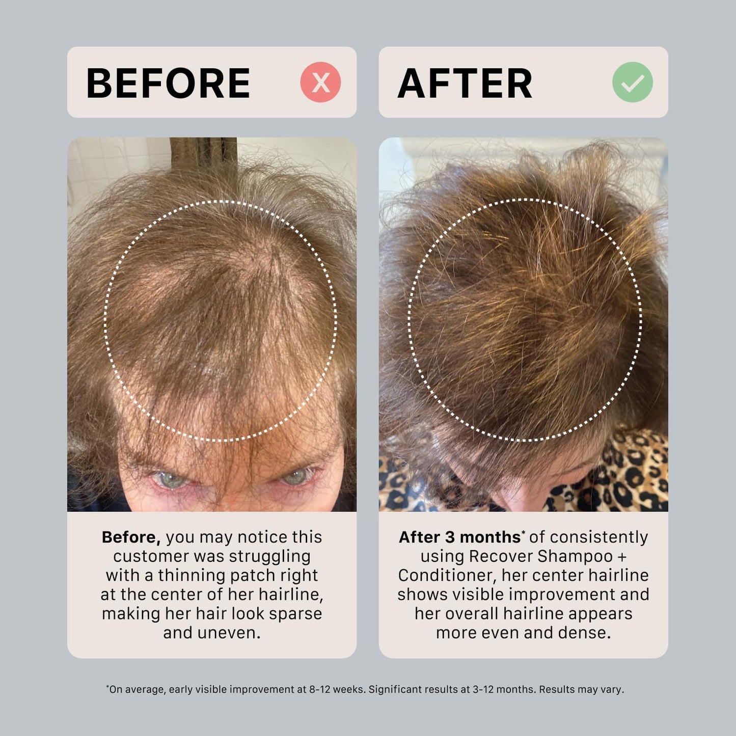 ACTIIV Ultimate Power Trio For Women | Boosts Fuller-Looking Hair, Strengthens, Soothes Scalp, Includes Shampoo, Conditioner & Serum, Vegan