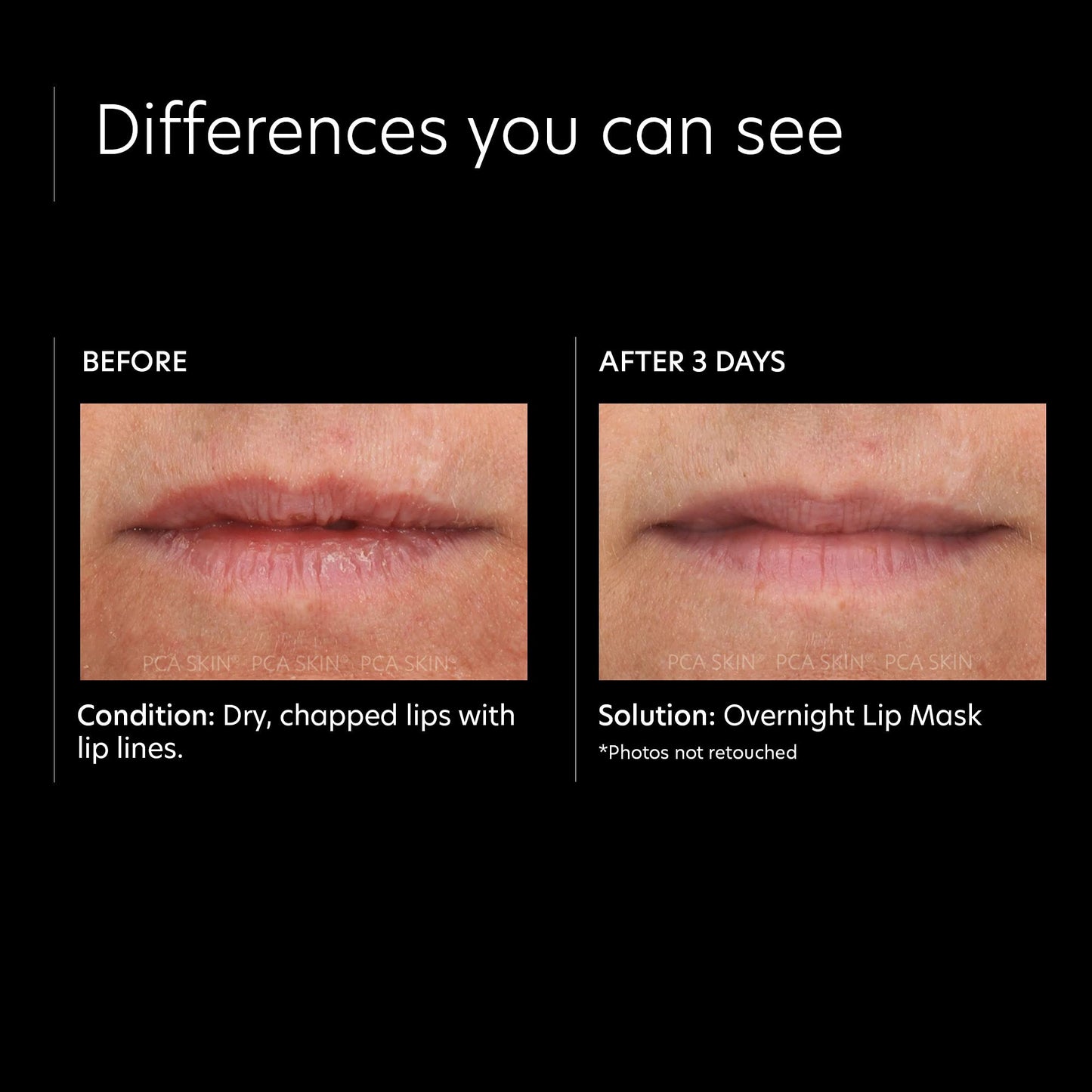 PCA SKIN Overnight Lip Balm Mask - Ultra-Moisturizing Lip Skin Care Treatment, Restores Moisture & Hydrates Dry, Chapped Lips while Sleeping (0.46 oz)