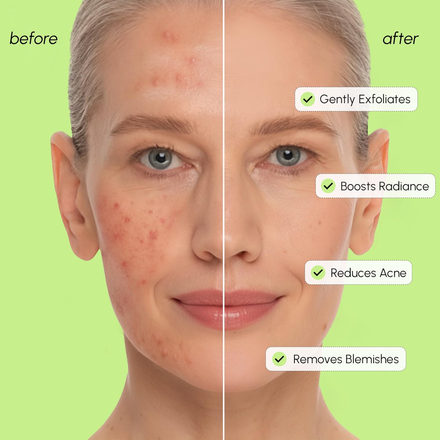 MAREE Exfoliating Toner with Salicylic Acid - AHA BHA Face Exfoliant & Pore Cleaner - BHA Liquid Exfoliant for Sebum & Dead Skin Care Remover - Face Beauty and Personal Care MAREE