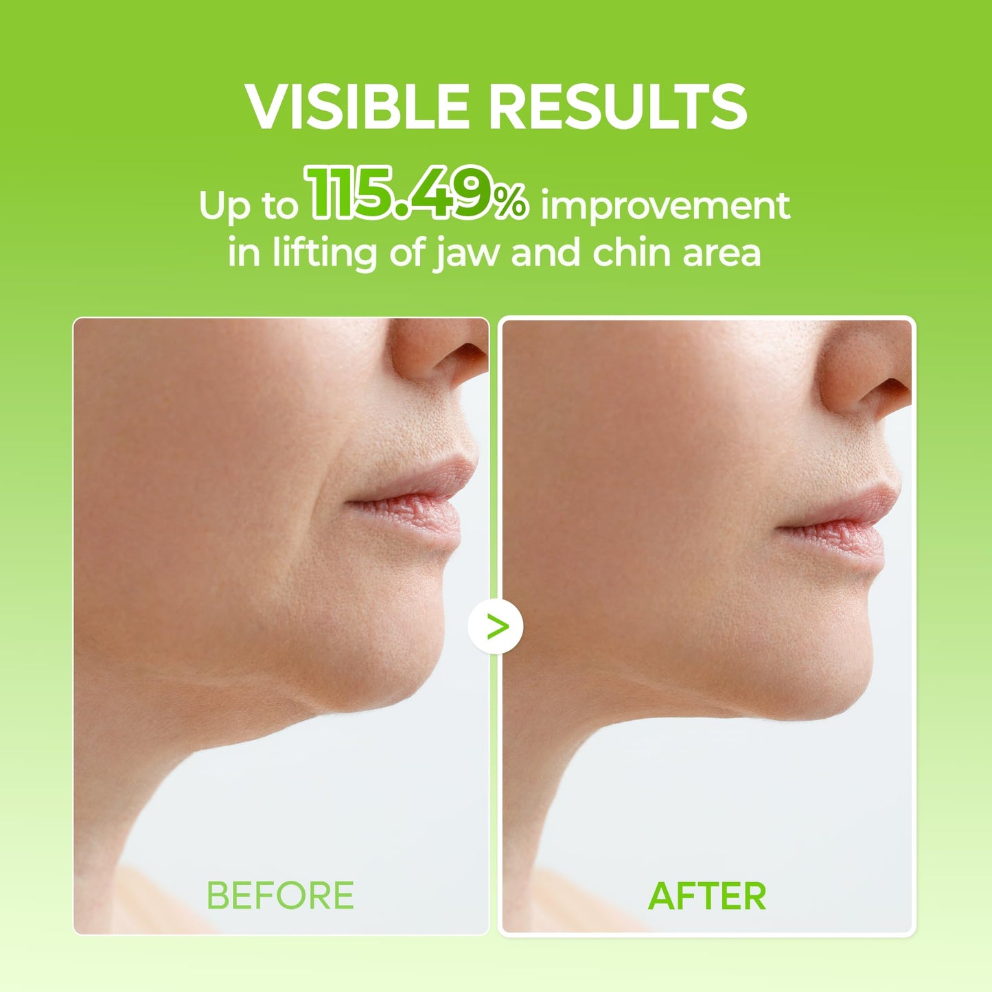 Dr.Melaxin CACTOX V-Lifting Mewing Band - Cactox + Caffeine + Collagen Double Chin Lifting Band for Sagging Jawline & Facial Puffiness | 115.49% Jaw Beauty and Personal Care Dr.Melaxin