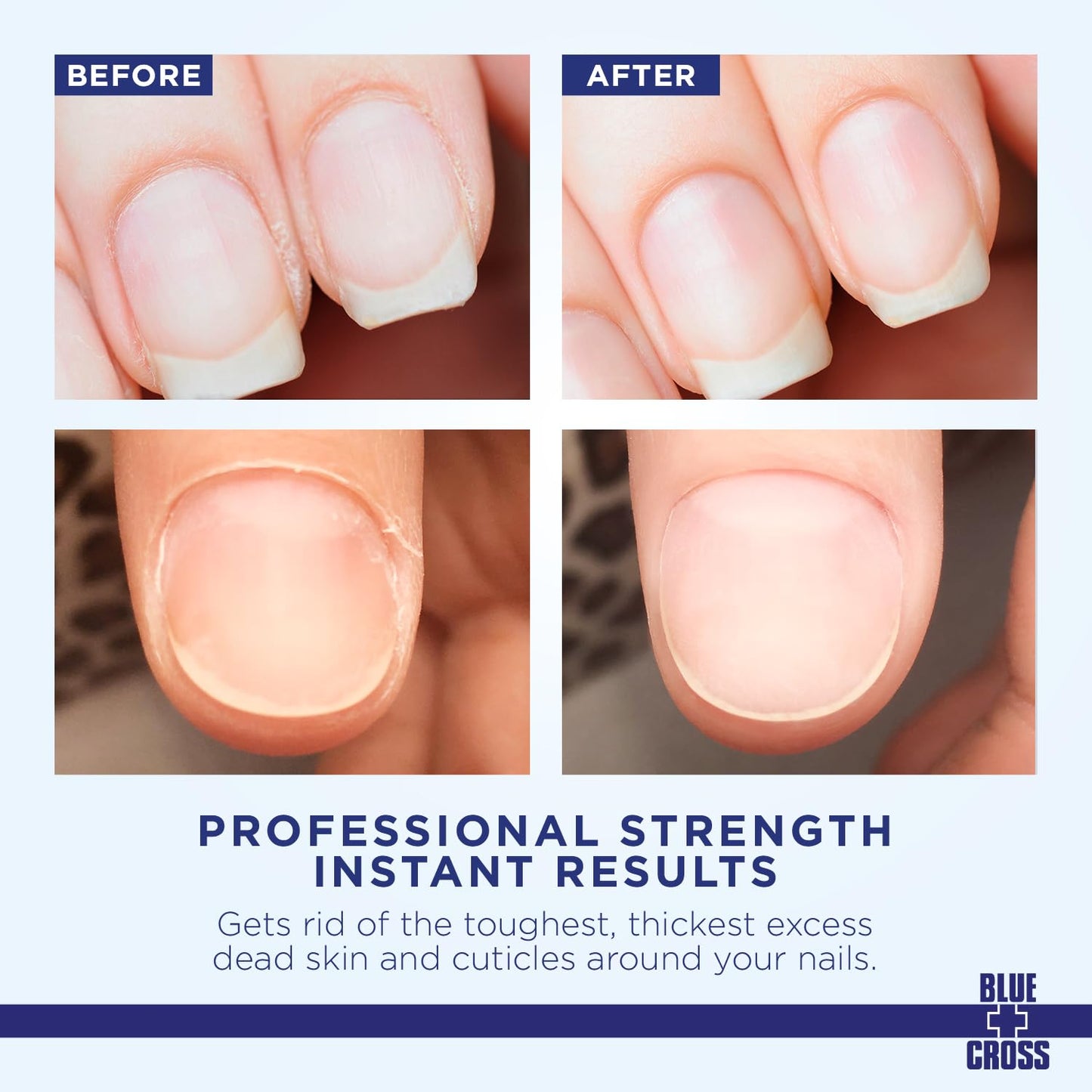 Blue Cross Cuticle Remover Cream for Dry Damaged Cuticles, Moisturizing Cuticle Softener for Nails, Professional Nail Care for Dry Manicures, Brittle Beauty and Personal Care Blue Cross