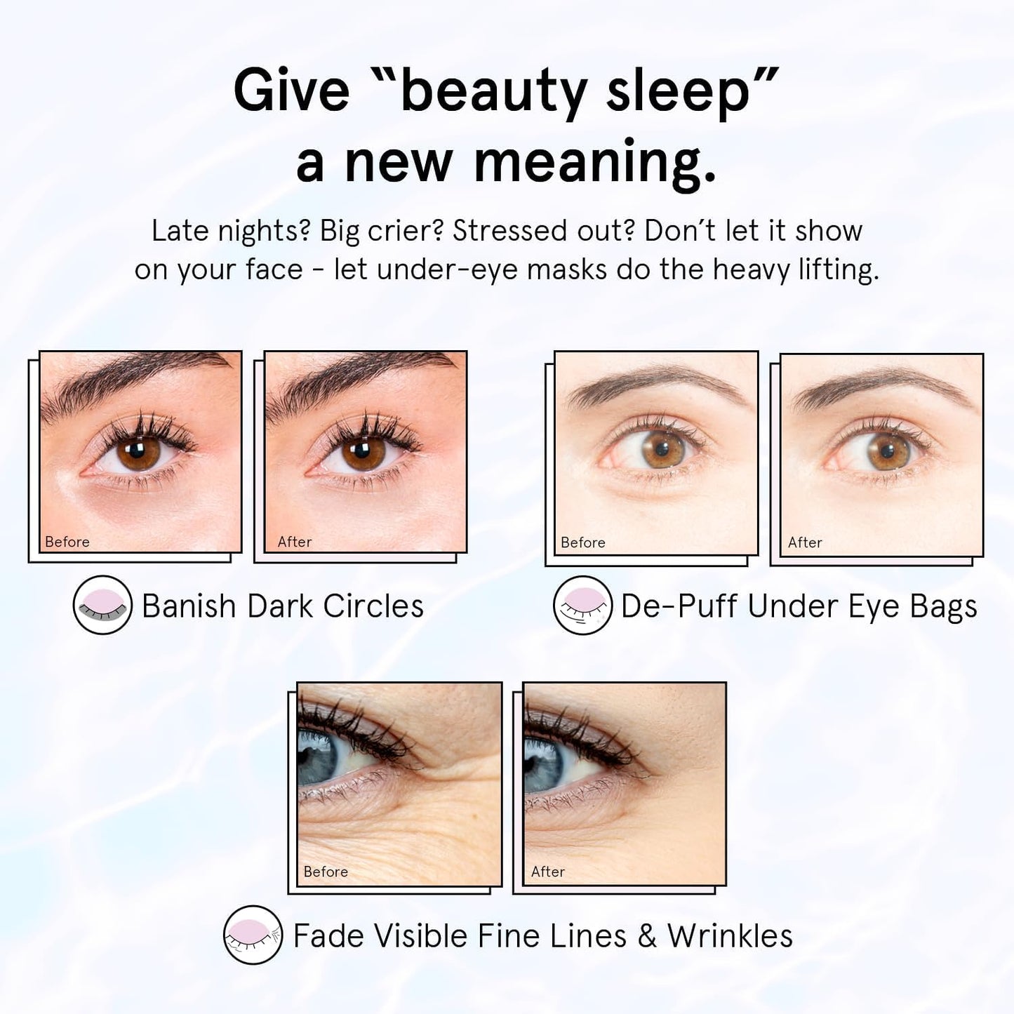 grace & stella Retinol Under Eye Patches for Puffy Eyes & Dark Circles - Restoring Gel Under Eye Masks with Hyaluronic Acid - Birthday Gifts Beauty & Personal Care grace & stella