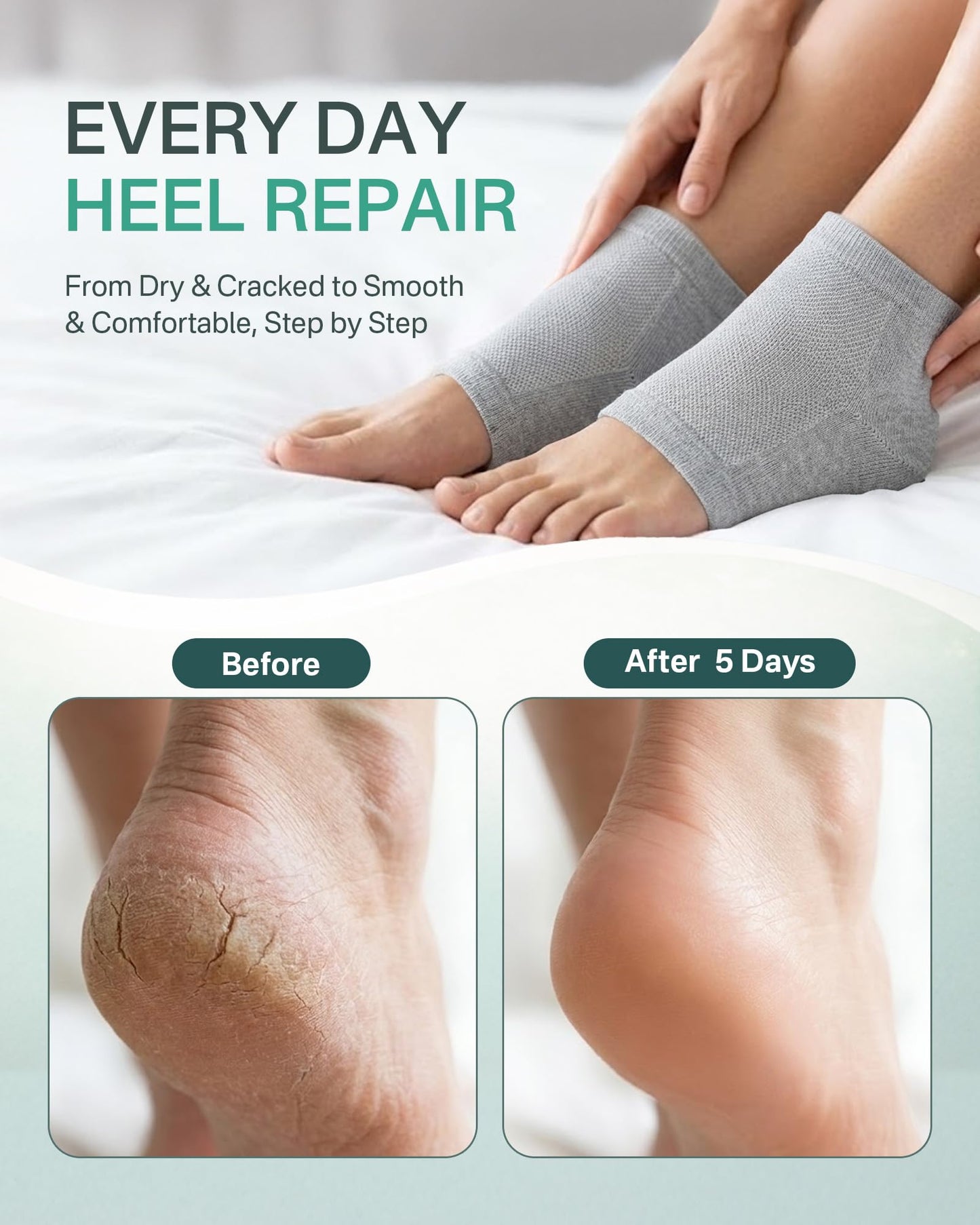 Moisturizing Socks for Women, Silicone Socks & Gel Socks, Heel Socks for Dry Cracked Feet, Heel Protectors for Cracked Heel Treatment, Foot Care Beauty and Personal Care Originbuty
