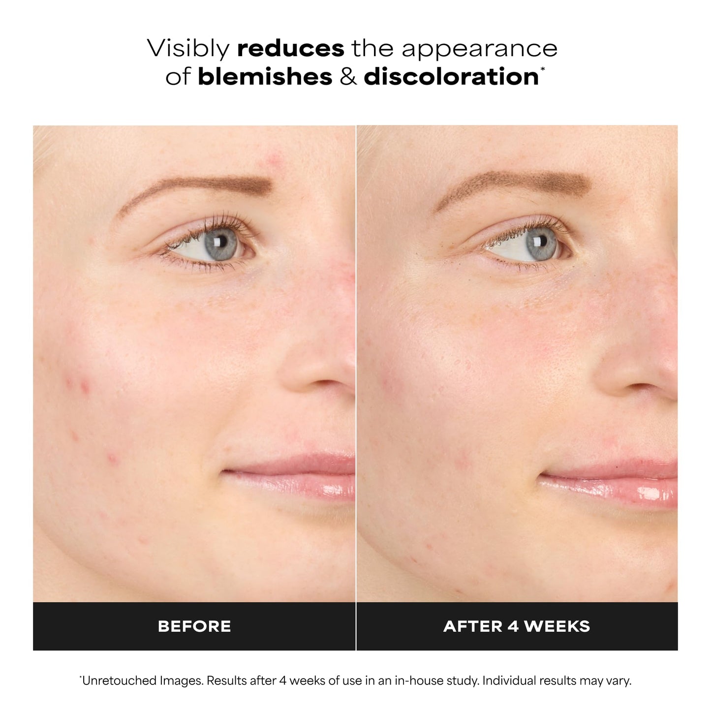 Paula’s Choice BOOST 10% Azelaic Acid Booster Cream Gel, Oil-Free Serum Fades Discoloration & Post-Blemish Marks, with Licorice Extract & Salicylic Beauty and Personal Care Paula's Choice