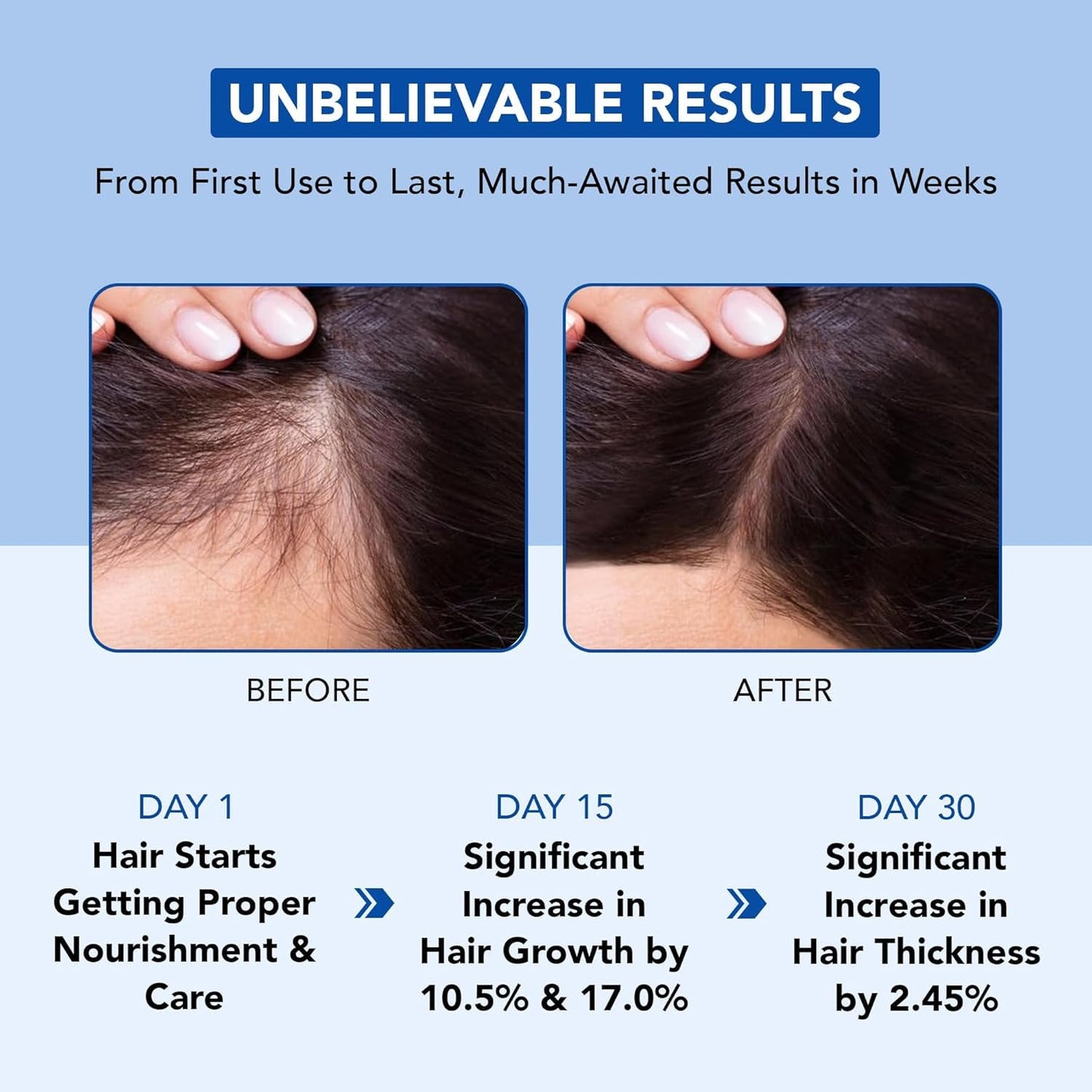 Botanic Hearth Hair Oil for Hair Growth | Rosemary Oil for Hair Growth with Biotin, Castor & Jojoba | Hair Relaxers & Dry Scalp Treatment | Color Safe Beauty and Personal Care Botanic Hearth