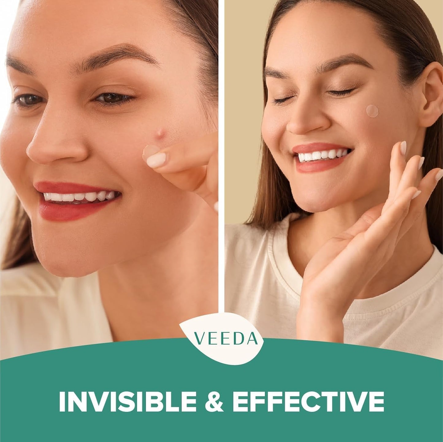 Veeda Glow Pimple Patches - Hydrocolloid Acne Stickers for Fast Healing, Invisible & Non-Irritating Zit Covers, Blemish Spot Treatment, 72 Count