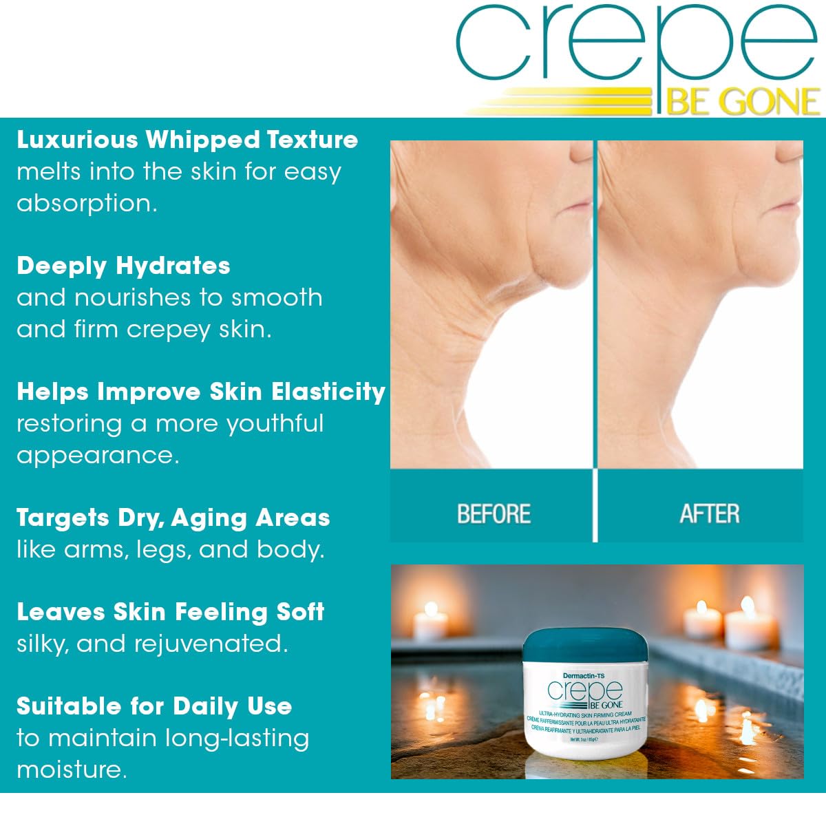 Dermactin Crepe Be Gone Body Souffle 2.5 ounce (6-Pack)