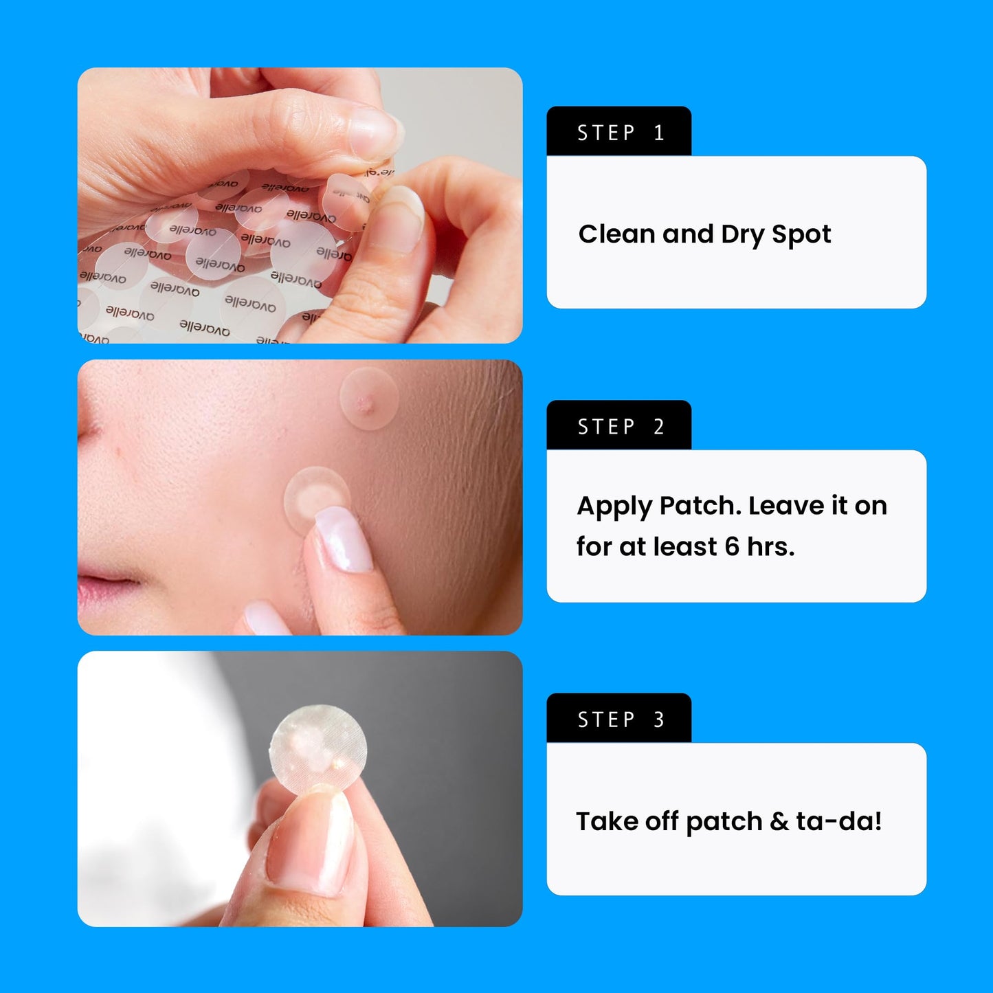 AVARELLE Pimple Patches for Face | Hydrocolloid Acne Patches for Covering Blemishes | FSA HSA Store Eligible Zit Patches with Tea Tree, Calendula Beauty and Personal Care AVARELLE