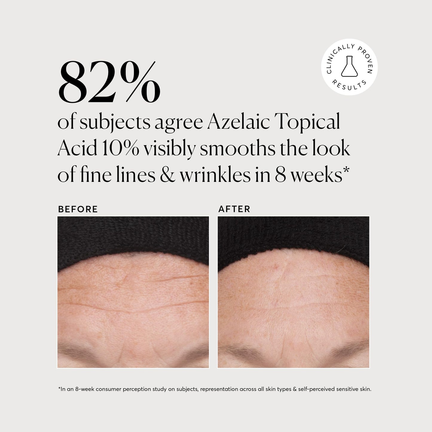 Naturium Azelaic Topical Acid 10%, Face & Skin Care Beauty Treatment with Niacinamide & Vitamin C, 1 oz Beauty and Personal Care Naturium