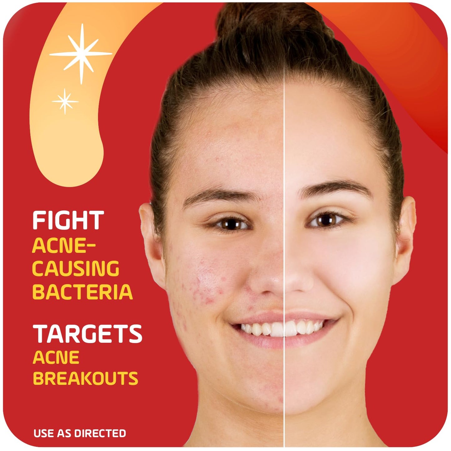 Asepxia 2% Salicylic Acid Acne Spot Treatment Cream | Drying Formula Targets Acne, Clears & Prevents Blemishes, Reduces Redness, Penetrates Pores