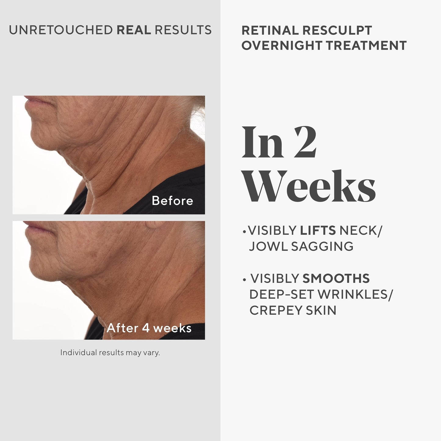 Murad Retinal ReSculpt Overnight Treatment - Advanced Face and Neck Serum with Encapsulated Retinal, Kangaroo Paw, Olive, & Oat Smooths Deep Wrinkles
