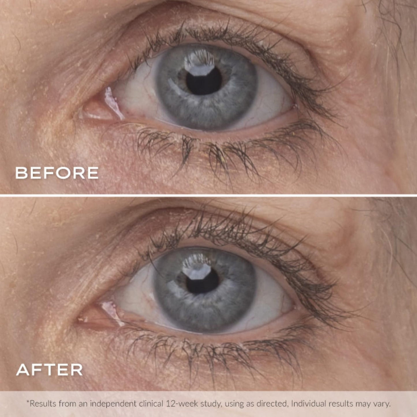 Younique's MOODSTRUCK ESTEEM Lash Serum | Eyelash Serum for Longer, Thicker and Stronger Lashes