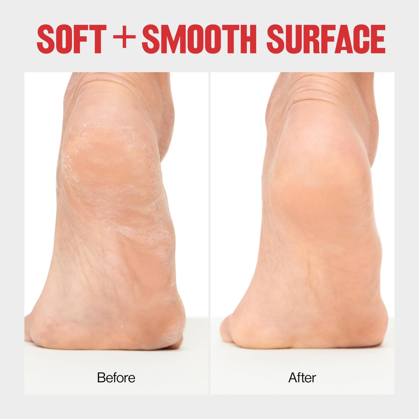 Revlon Callus Remover, Foot File with No-Mess Cover, Gently Exfoliates and Smooths Feet, Softens Calloused Areas, Stocking Stuffer for Women, 1 count