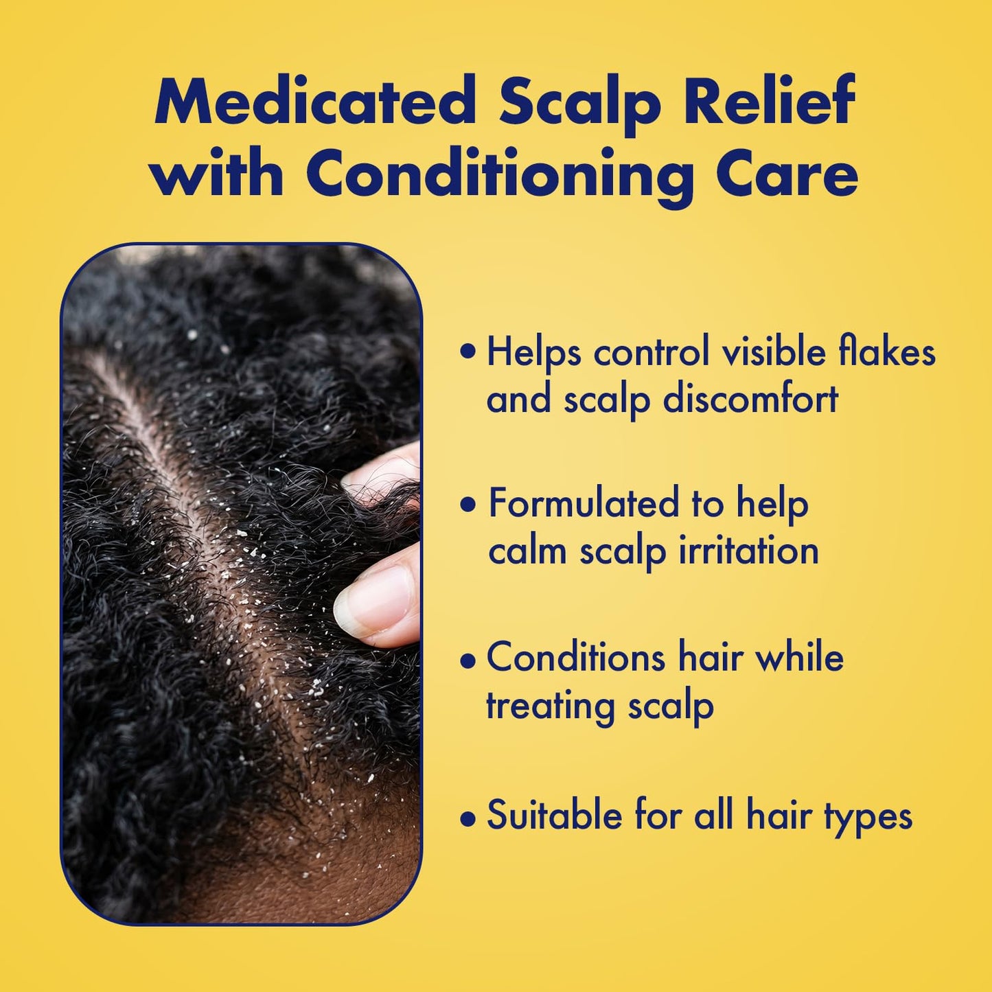 SULFUR8 Medicated Anti-Dandruff Hair & Scalp Conditioner 2 oz - Helps Control Dandruff, Soothes Itchy Scalp & Moisturizes Hair with Refreshing Clean Beauty and Personal Care SULFUR8