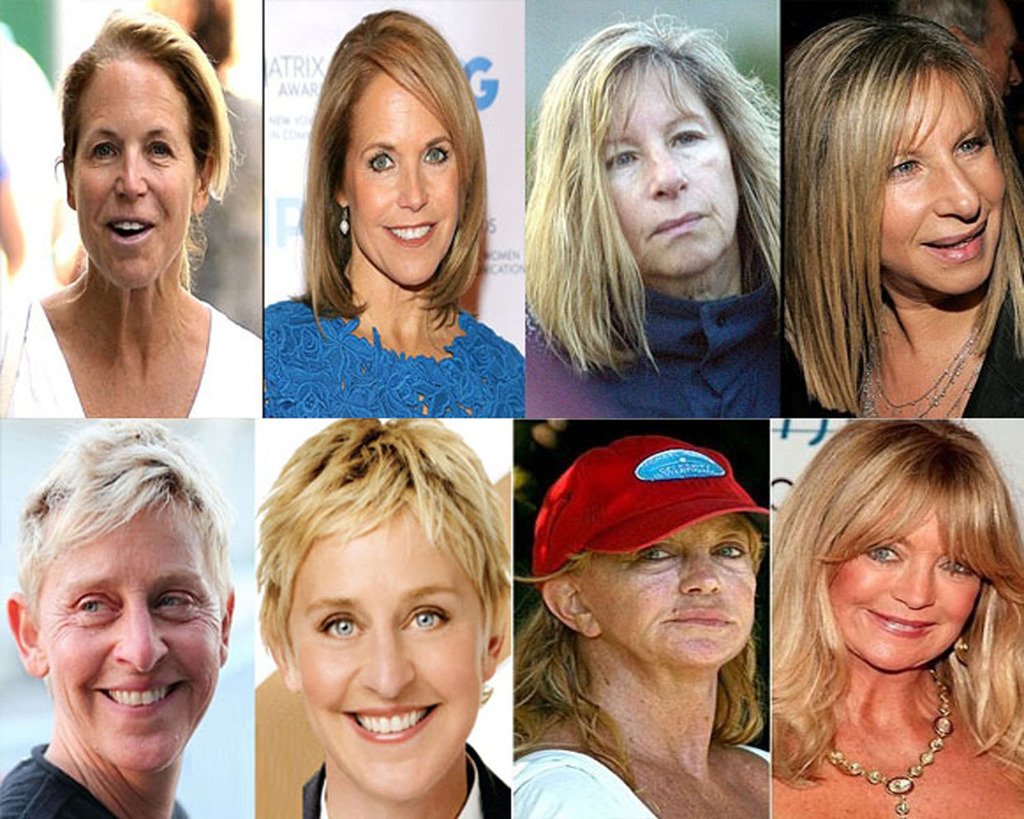 DNA Code®-No Needle Alternative-Pure Argireline Peptides Winkle Reduce Cream-Hyaluronic Acid+ Matrixyl 3000