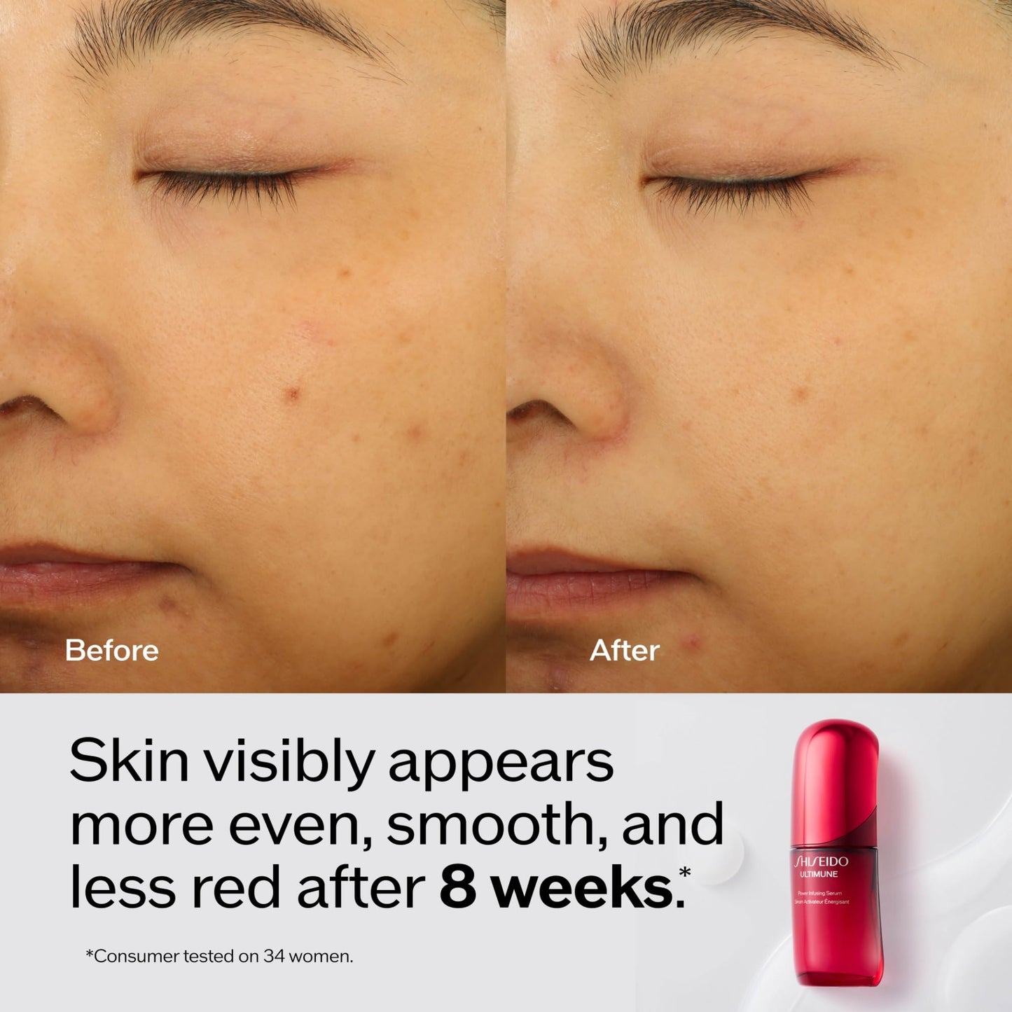 Shiseido Ultimune Power Infusing Serum - 2.5 oz - Breakthrough Lightweight Face Serum - Boosts Radiance & Improves Visible Signs of Aging - All Skin Beauty & Personal Care Shiseido