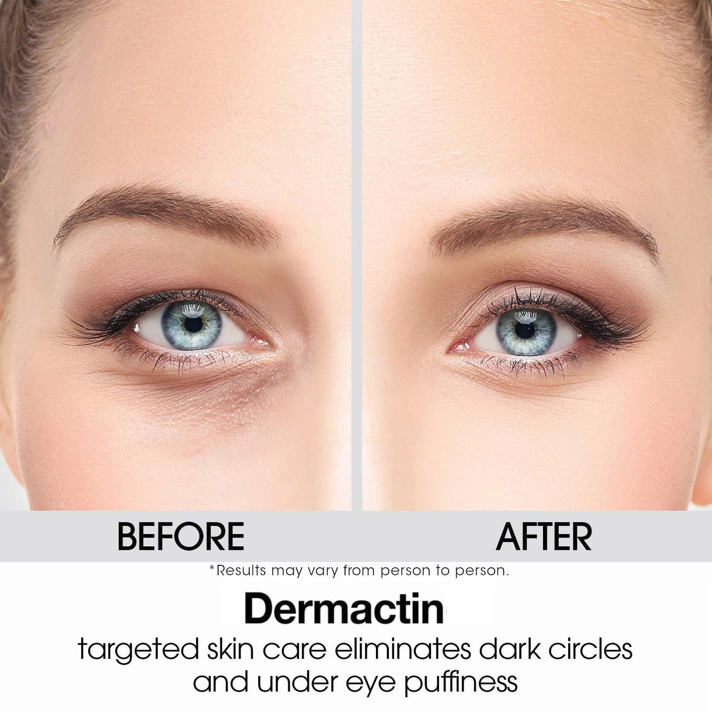 Dermactin Upper Eyelid Cream 1 oz – Firms & Tones Drooping Lids for a Youthful, Vibrant Look | Gentle Formula for Sensitive Eyelid Skin