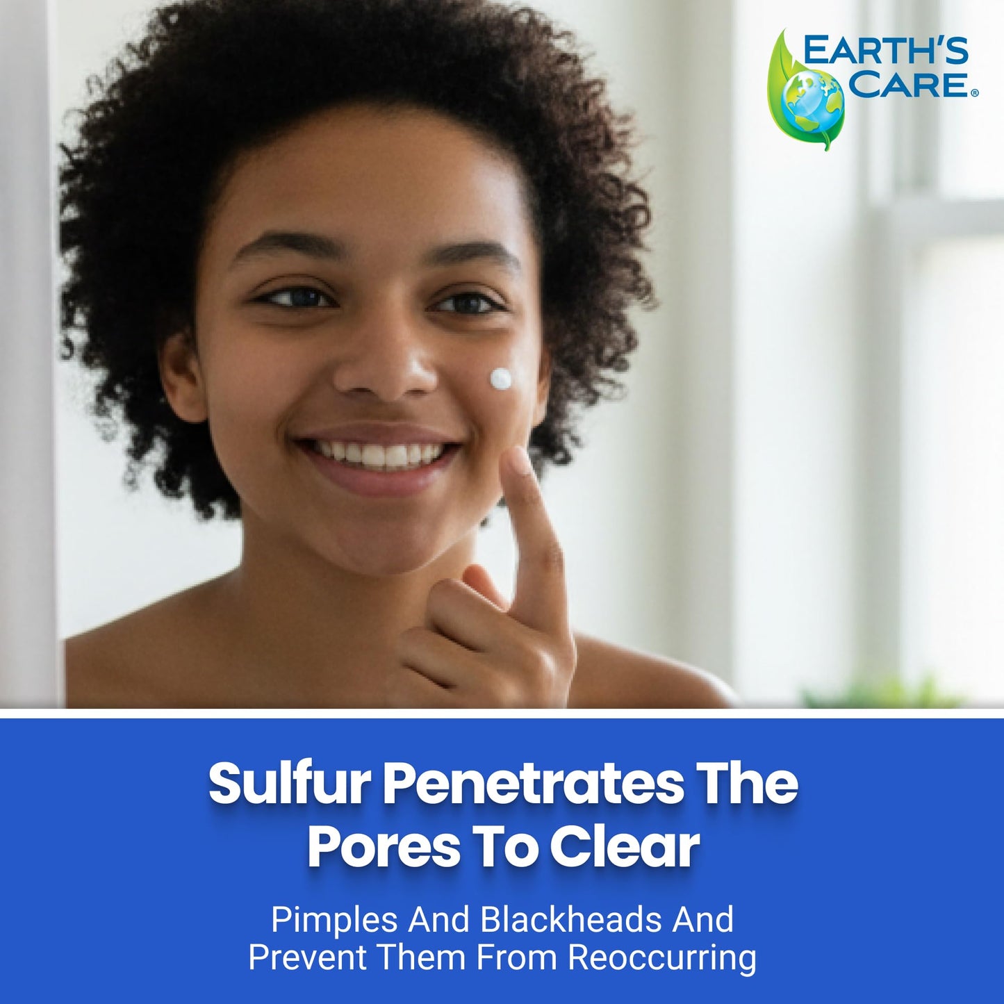 Earth's Care Acne Spot Treatment - 10% Sulfur Cream Medication to Clear Cystic Acne, Pimples and Blackheads on Face and Body (Tube 0.97 OZ)