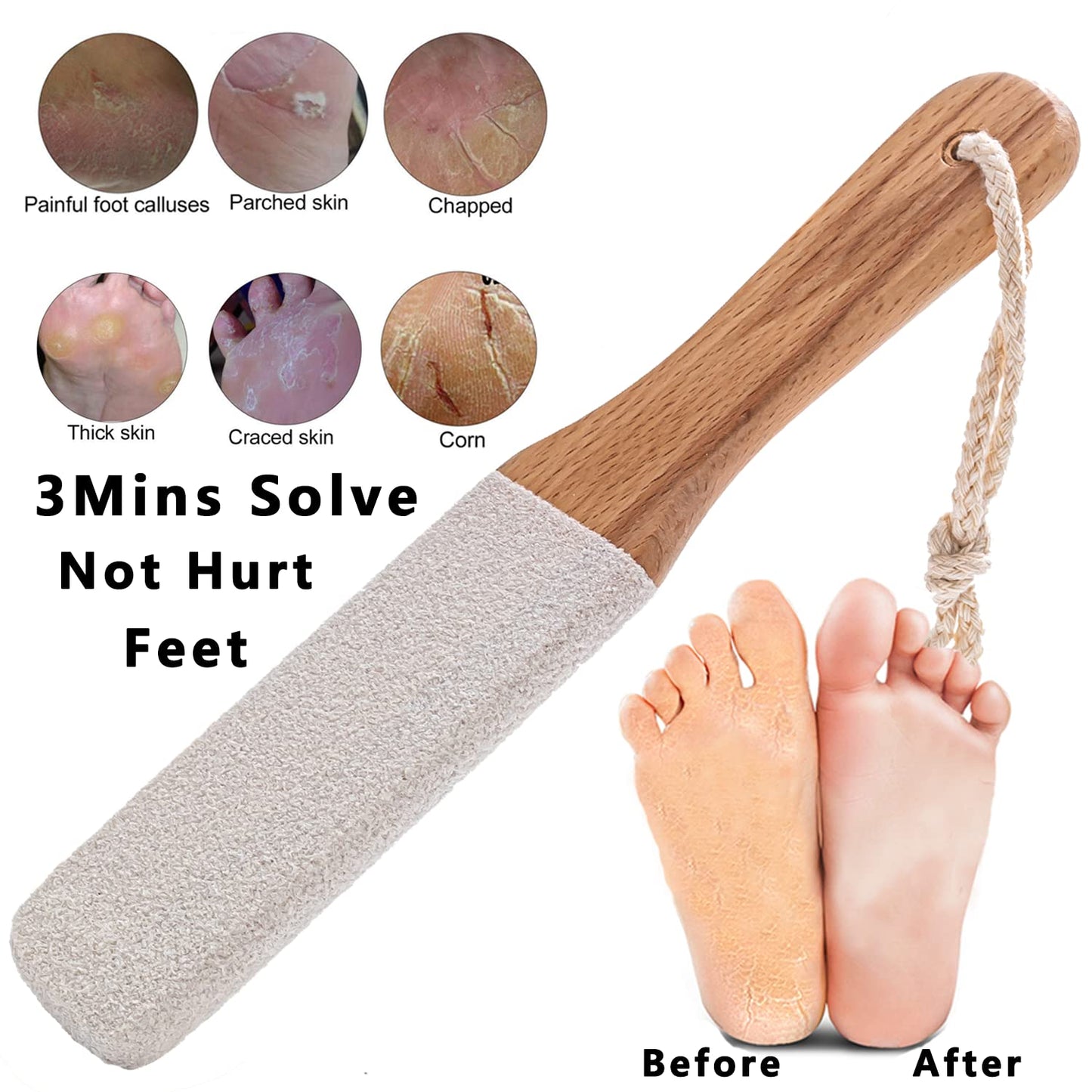 Kinepi Callus Remover Foot Scrubber Colossal Foot File Foot Care and Foot Exfoliator Foot Rasp Pedicure Tools Pumice Stone for Feet,Remove Corn Hard