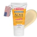 De La Cruz Sulfur Ointment - Cystic Acne Treatment for Face and Body - Daily 10 Min Spot Treatment Mask - Safe and Effective Game Changing Hormonal
