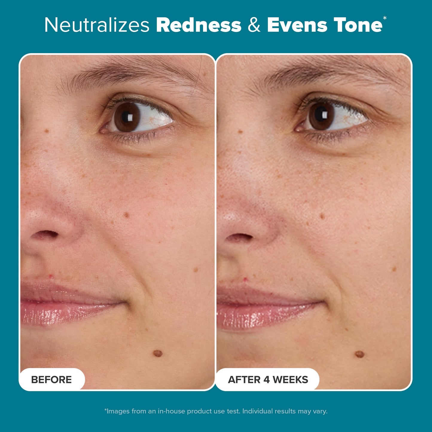 Paula's Choice Skin Balancing Pore-Reducing Face Toner with Niacinamide, for Oily Skin & Combination, Minimizes Large Pores, Controls Oil & Shine