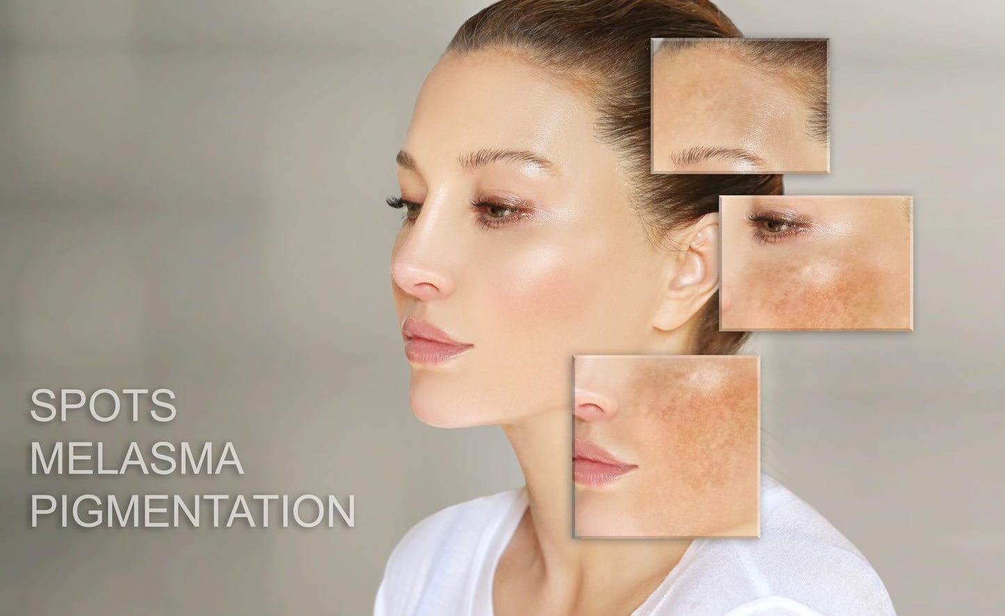 MT Skin Clinic Day Cream Moisturizer for Face Hydration Skincare for Sensitive Skin Acne Treatment and Redness Reducing Moisturizing Facial Cream