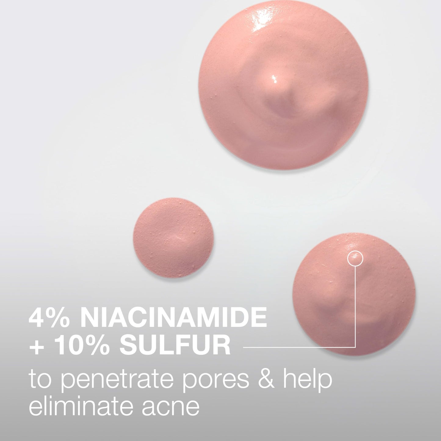 Neutrogena Stubborn Acne Spot Drying Lotion, Fragrance-Free Sulfur Acne Treatment Clears Acne By Drying Up & Shrinking Pimples, Paraben- & Oil-Free