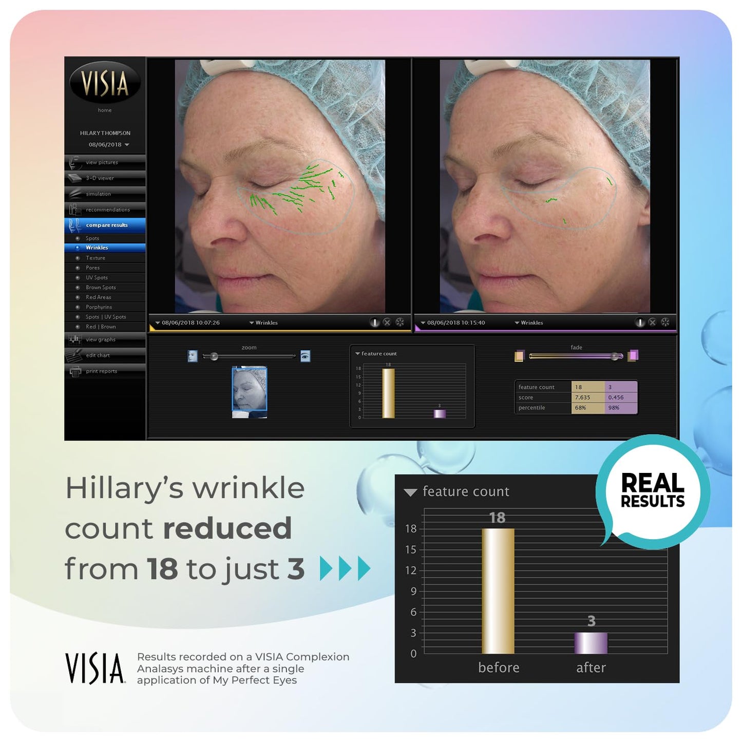 My Perfect Eyes by Penny Lane | Anti-Aging Eye Cream for Dark Circles & Puffiness | Instant Firming Treatment for Wrinkles & Fine Lines | Undereye