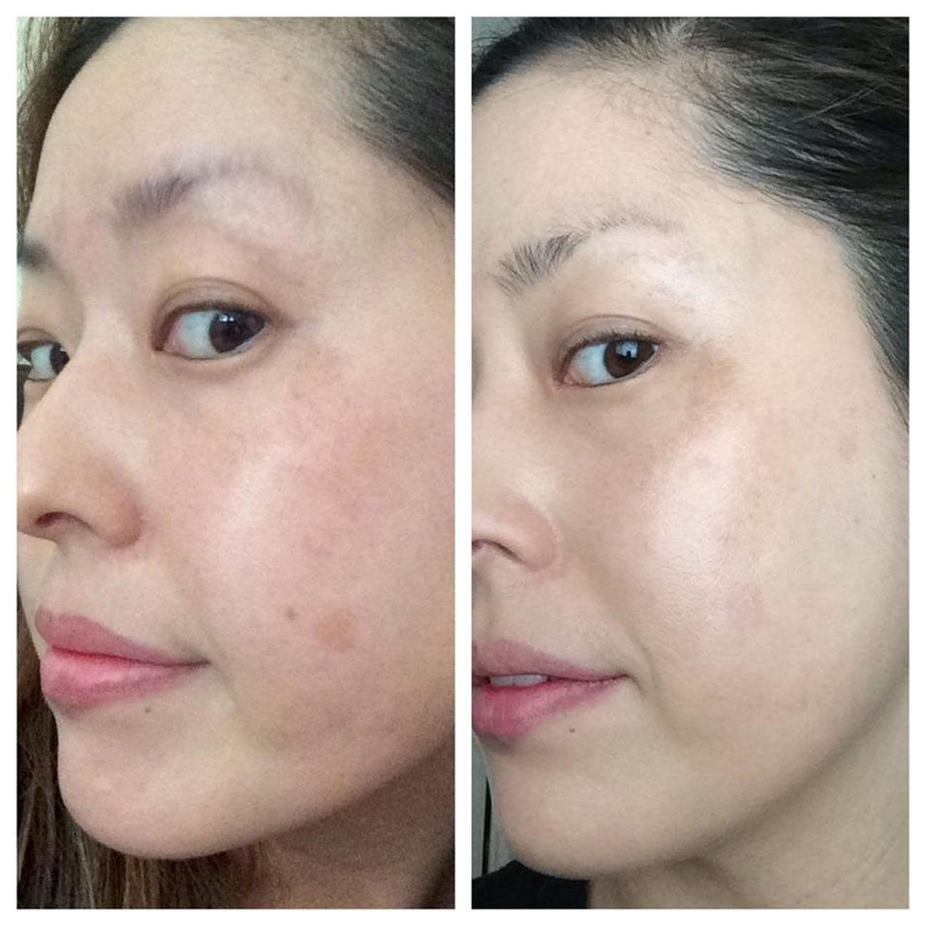DNA Code®- 20% Glycolic Acid Complex Skin Renewal Moisturizer w/Retinol, CoQ10, B5 and More Beauty & Personal Care DNA Code