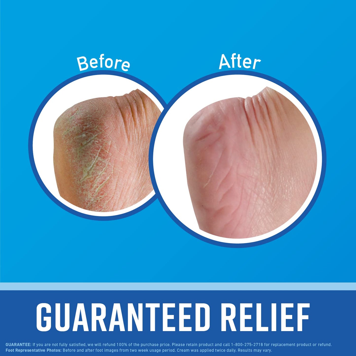 O'Keeffe's for Healthy Feet Foot Cream; Guaranteed Relief for Extremely Dry; Cracked Feet; Instantly Boosts Moisture Levels; 3.2 Ounce Jar; (Pack