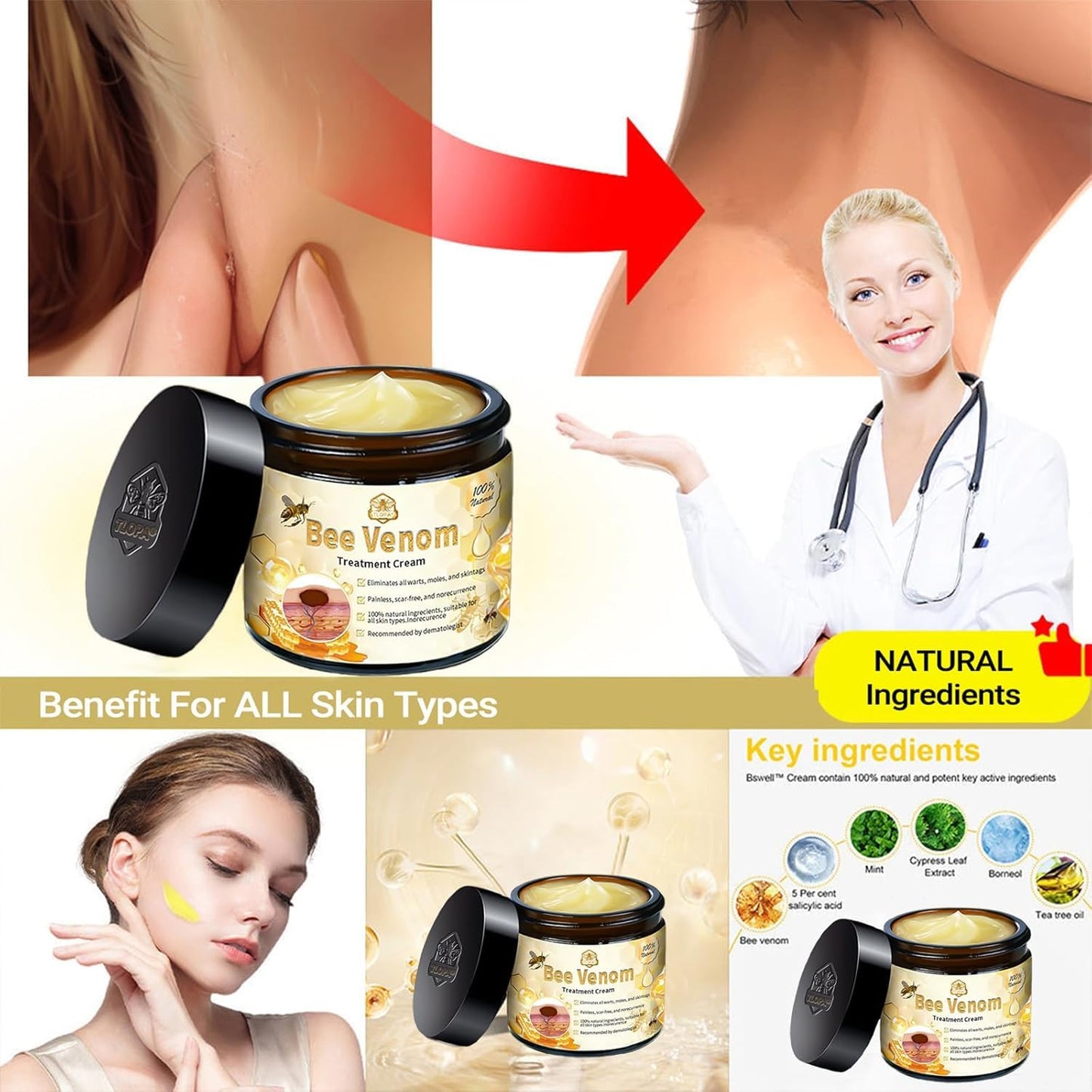 Bee Venom Skin Treatment Cream, 2024 New Bee Venom Repair Cream, Professional Bee Venom Cream-30g, Repair Maximum Strength for All Skin Types (1