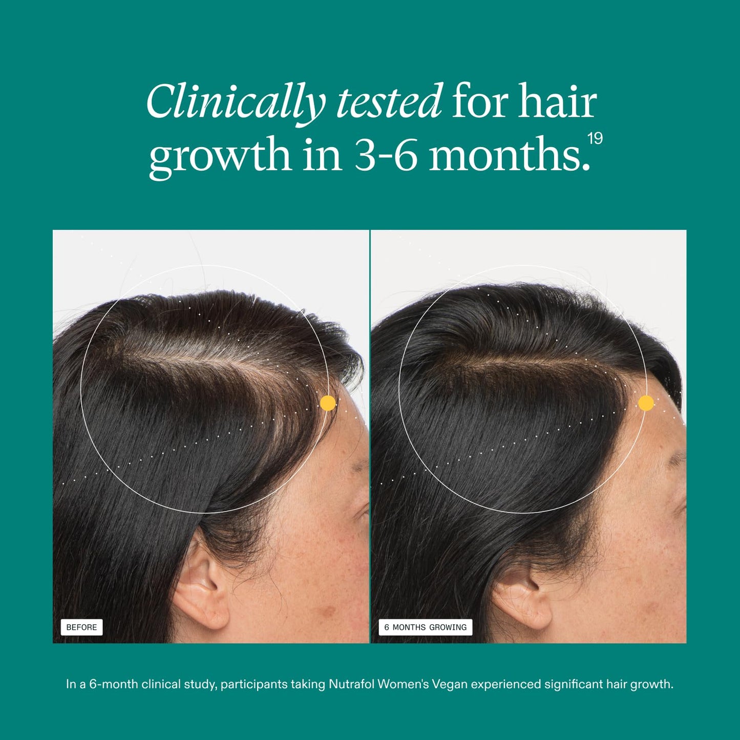 Nutrafol Women's Hair Growth Supplements, for Women 18-44 Years Old, Clinically Tested for Visibly Thicker, Stronger Hair, 100% Vegan Ingredients Beauty and Personal Care Nutrafol