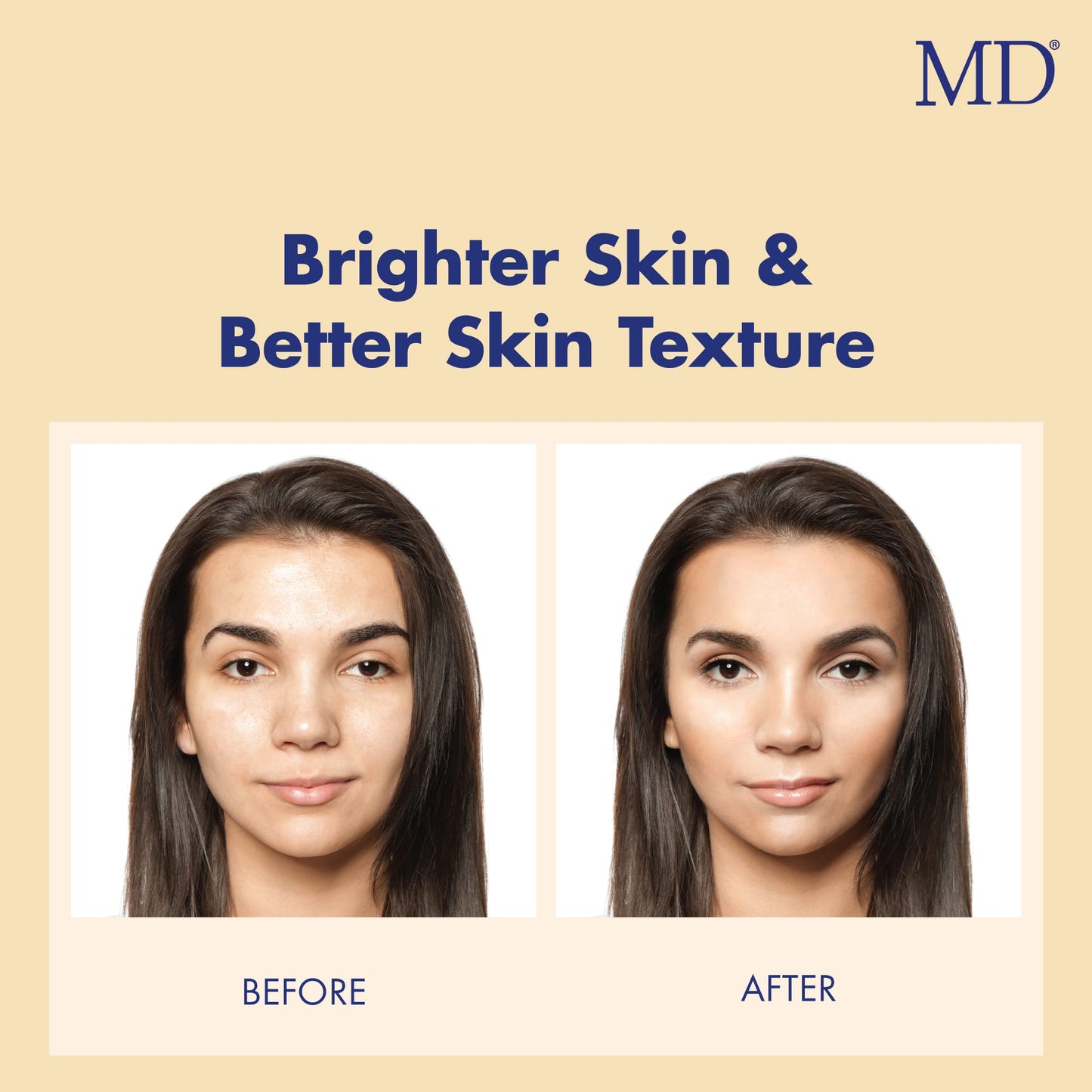 MD Ultimate Vitamin C Serum - Anti-Aging Face Serum with L-Ascorbic Acid for Dark Spot Reduction, Fine Line & Wrinkle Care, and Collagen Support