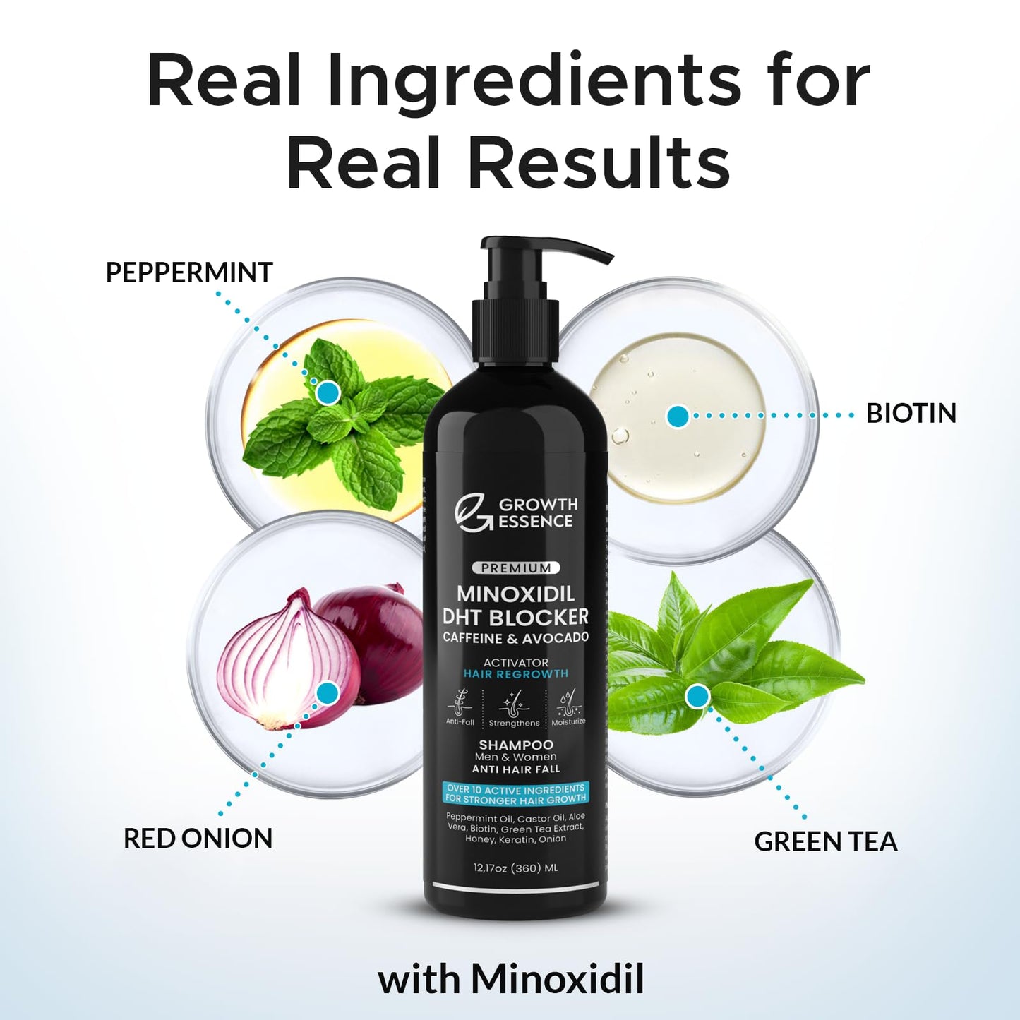 Minoxidil & Biotin Shampoo for Hair Growth - Enriched with Caffeine, Castor Oil & Onion - DHT Blocker for Thicker, Healthier Hair - Strengthening Beauty and Personal Care Growth Essence