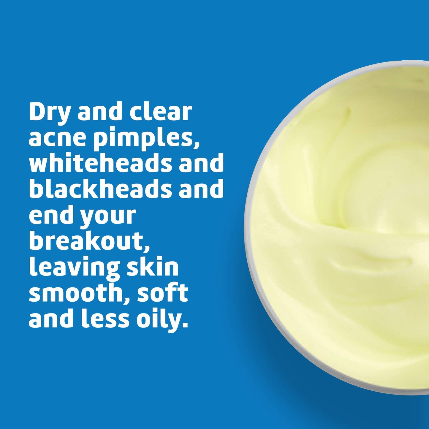 De La Cruz Sulfur Ointment - Cystic Acne Treatment for Face and Body - Daily 10 Min Spot Treatment Mask - Safe and Effective Game Changing Hormonal