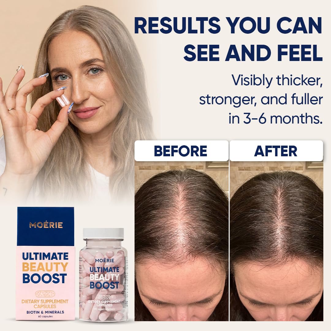 Moerie Ultimate Hair Boost Supplements for Women & Men - Hair, Skin, Nails Vitamins with Biotin & Minerals for Hair Health - Thicker Hair - 60 Beauty and Personal Care Moerie