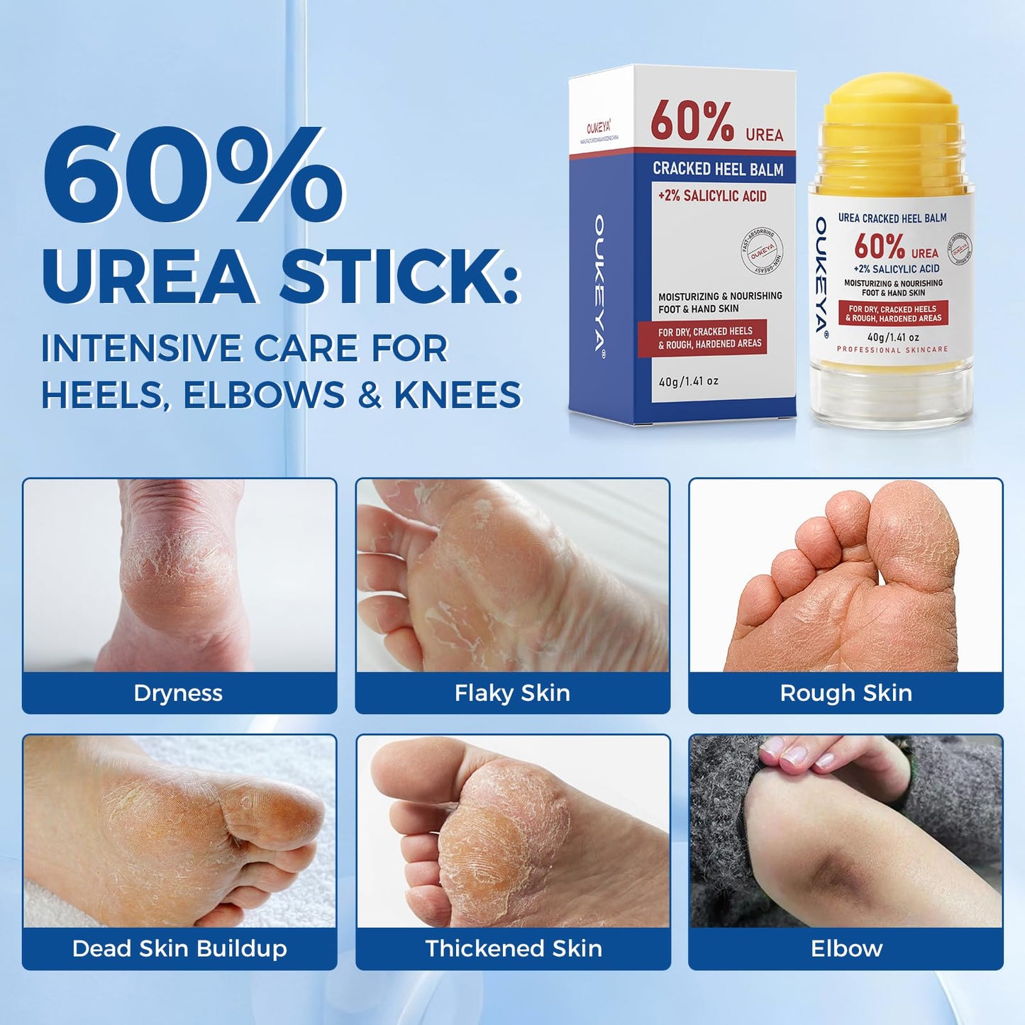 OUKEYA Urea Stick 60% to Soften & Smooth Dry, Cracked, Rough Skin Beauty and Personal Care OUKEYA