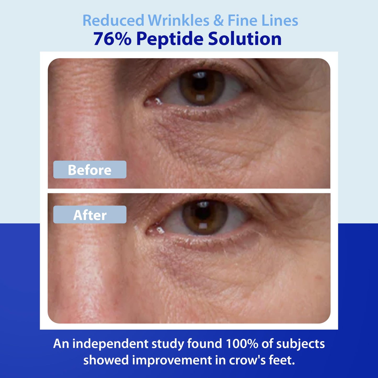 Dr. Denese Wrinkle RX 76% Peptide Solution Concentrate 1 oz - Supports Smoother, Firmer-Looking Skin With Lightweight Hydration - Doctor-Developed