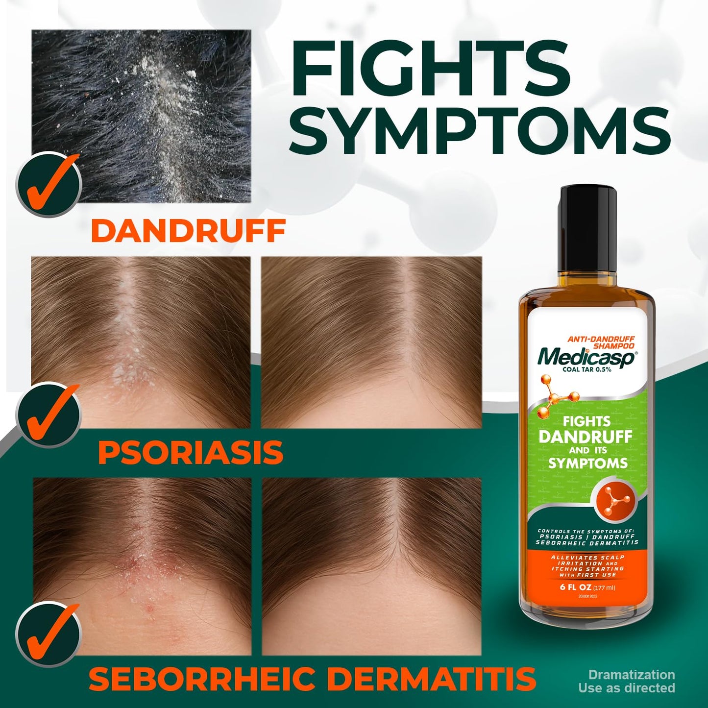 Medicasp Coal Tar Anti-Dandruff Shampoo, Flakes Shampoo, 6 fl oz, 2 Pk Beauty and Personal Care Medicasp