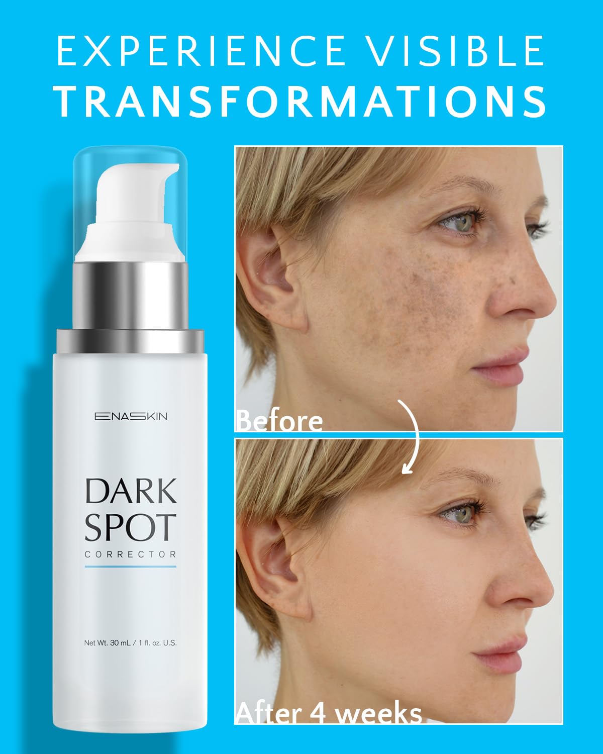 EnaSkin Dark Spot Remover for Face and Body: Advanced Formula Spot Corrector Cream to Fade Age Spots, Sun Spots, Freckles, Melasma, and Brown Spots Beauty and Personal Care EnaSkin