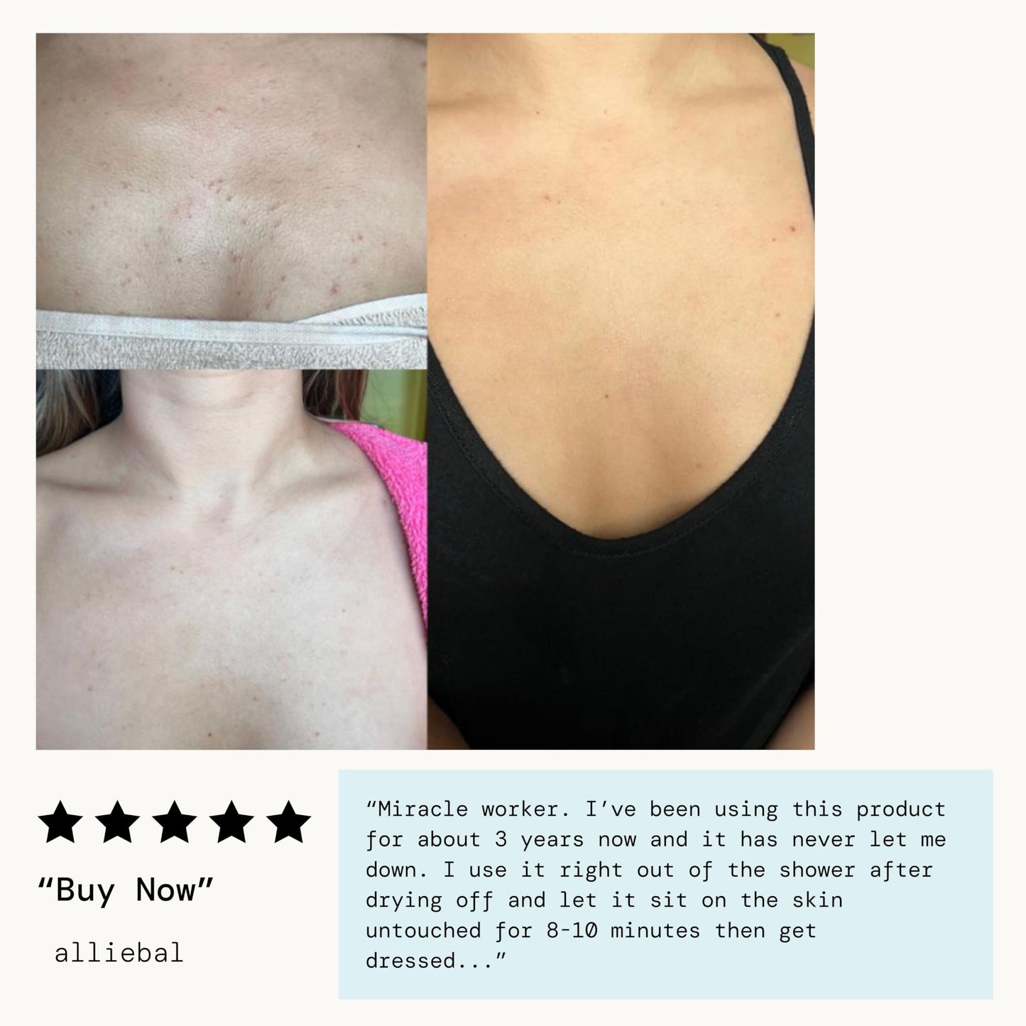 Pacifica Bacne Warrior Acne Spray – 2% Salicylic Acid, Niacinamide & Aloe – Body, Chest & Back Acne Treatment for Teens & Adults, Vegan