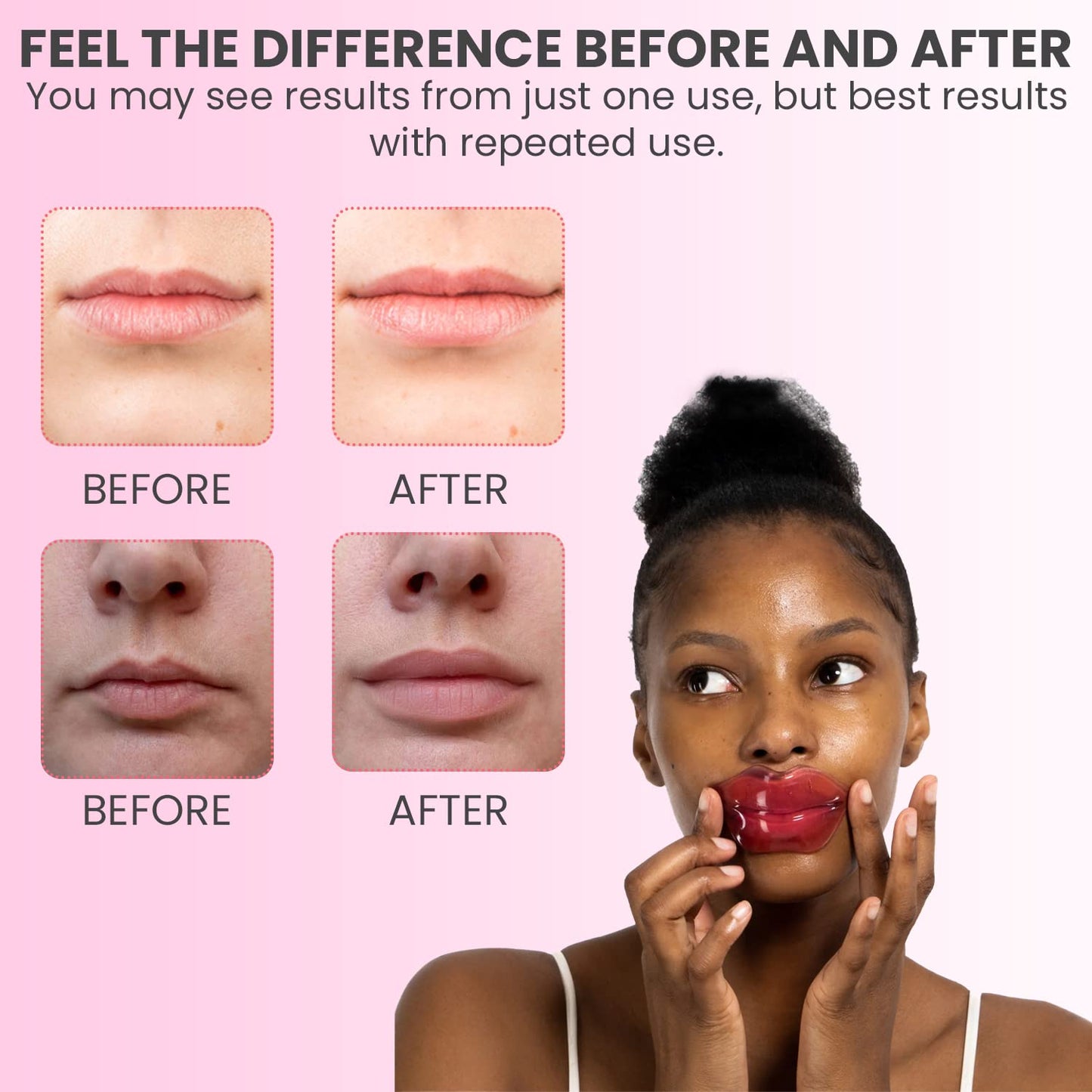 MISS SPA Lip Mask, Hydrate Boost Hydrogel Pink Lip Mask, Sooth Restore Lips, Lip Plumper, Moisturizing And Reducing Fine Lines, Anti-Aging Face Mask