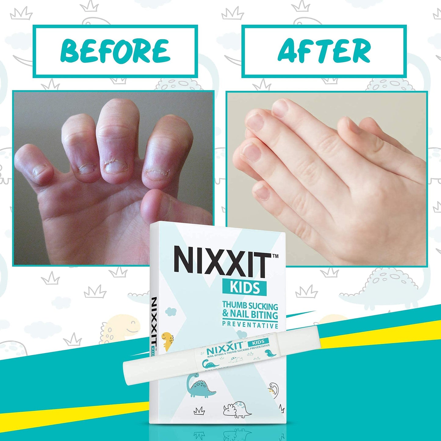 NIXXIT Nail Biting Treatment for Kids - Stop Thumb Sucking for Kids, Toddlers, Children - No Bite Nail Polish Pen - Non Glossy - Bitter Taste - Safe Beauty and Personal Care NIXXIT
