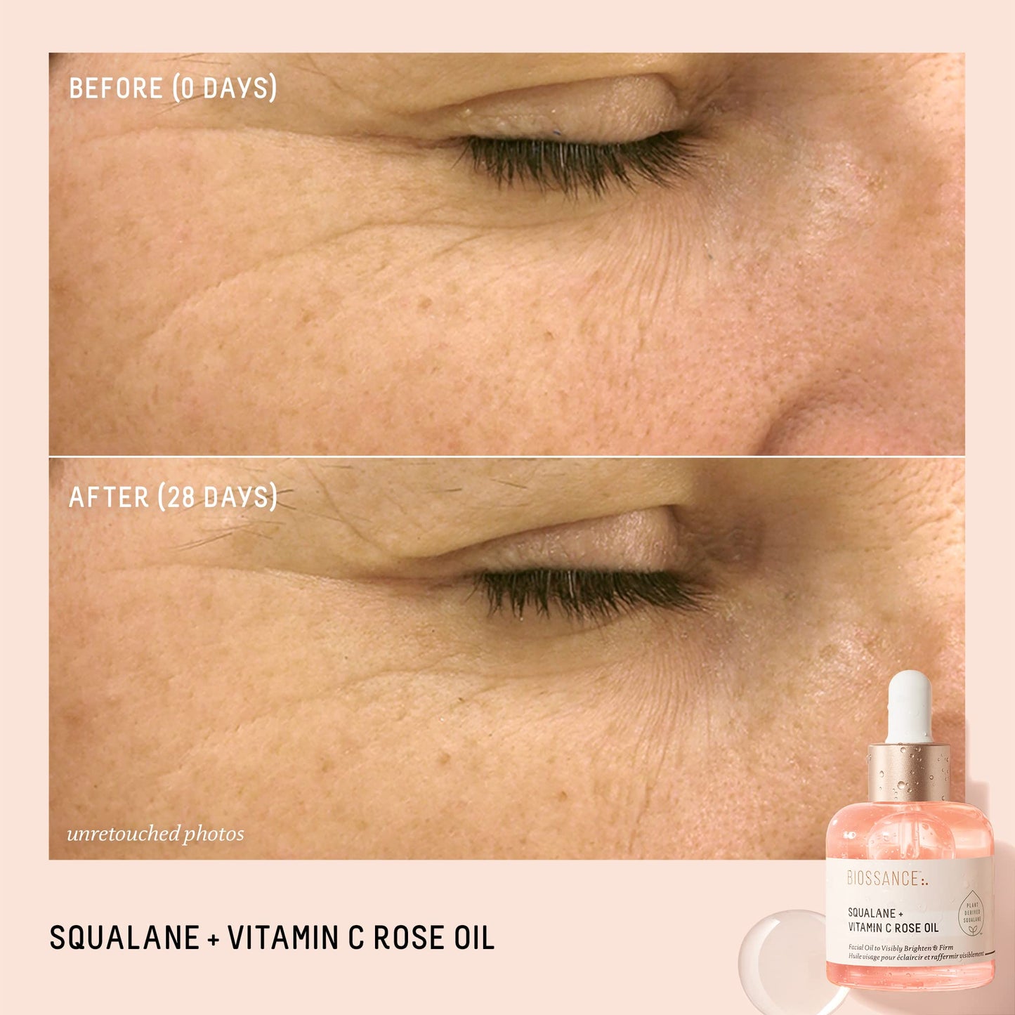 BIOSSANCE Squalane + Vitamin C Rose Advanced Facial Oil - Brightening, Firming, and Hydrating Serum for All Skin Types - Chios Crystal Oil, Damascus