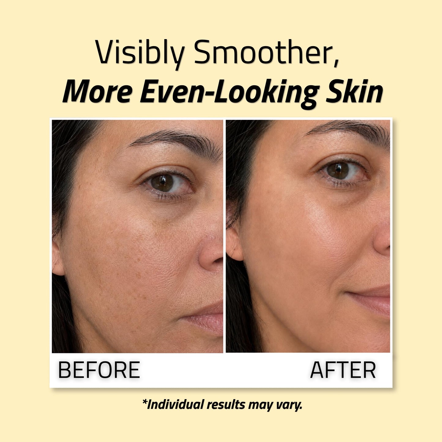 YEOUTH Niacinamide Serum for Face 10% with Hyaluronic Acid and Aloe Vera, Hydrating B3 Skin Care Face Serum for Women and Men, Hydrating Skincare Beauty & Personal Care YEOUTH